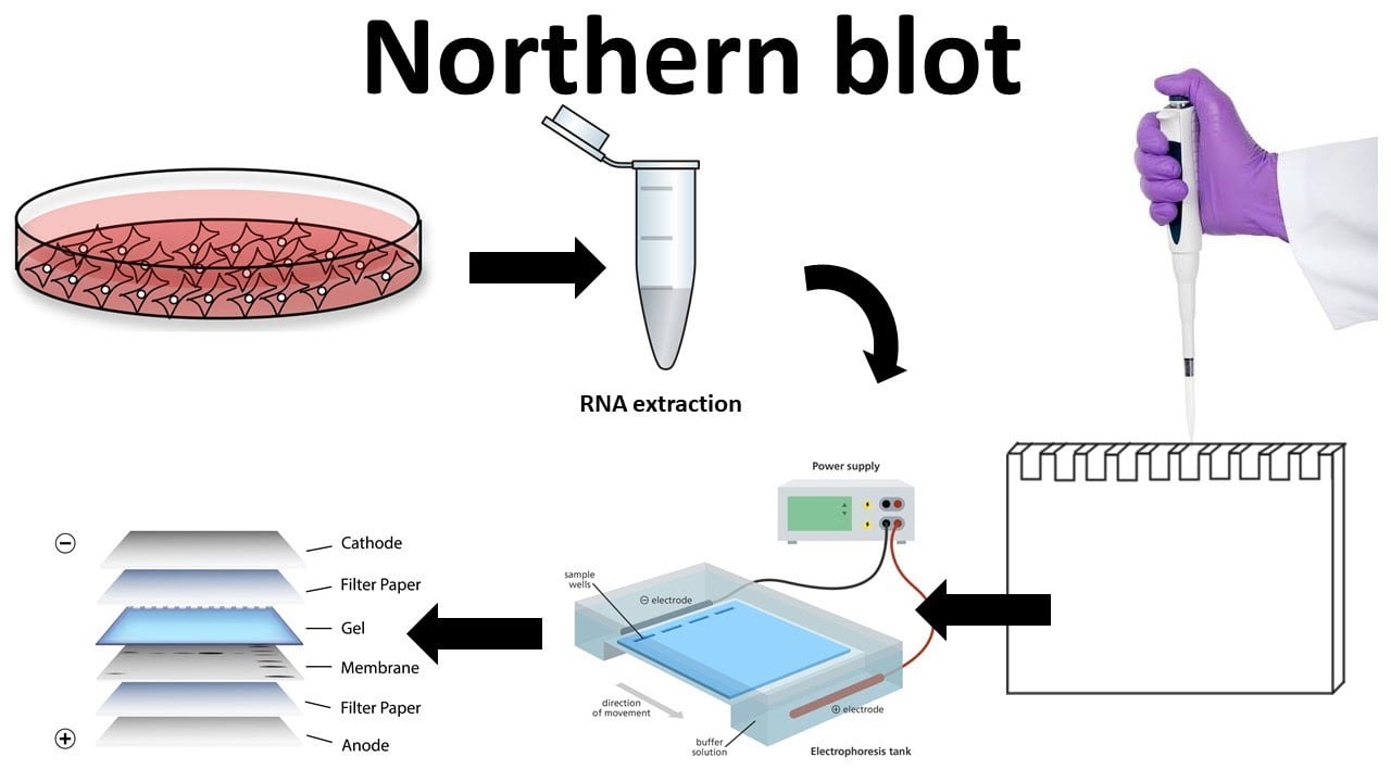 northern blotting procedure steps